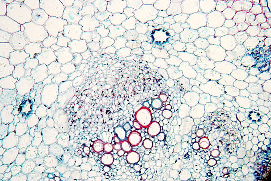 Stem cells help repair traumatic brain injury by building a biobridge, USF researchers report