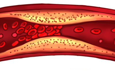 The Role of Luteolin in Preventing Arterial Plaque